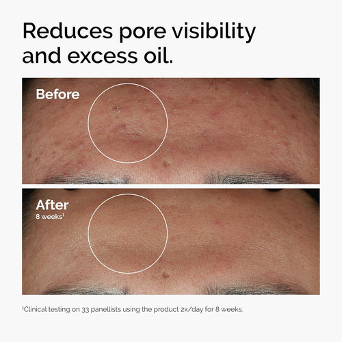 Radiant Summer Skin Serum